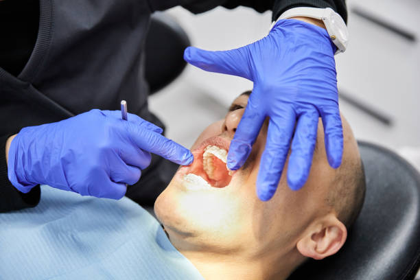 Best Emergency Wisdom Teeth Removal in Novi, MI